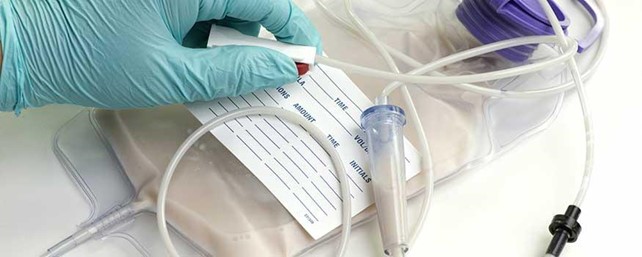 Picture1 Nurse hand preparing feeding tube